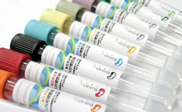 10月18日，人生就是博官方网站将加入韩国KSNS聚会