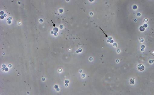 酵母双杂交手艺原理、试验流程、特点以及应用