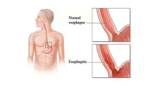首页-人生就是博中国官方网站