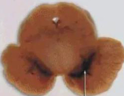 正凡人：正：谥