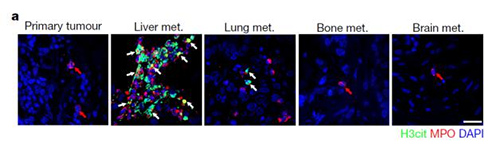 转入小鼠模子获得相同的试验效果，且在转移爆发前NET已在肝脏聚积。。