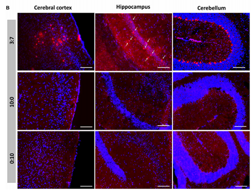 被包裹在含有NT-类脂质的LNP中的Cre重组酶乐成转移。。大脑中的转染神经元呈红色高亮。。