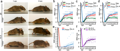 Hyper-IL-6增进功效恢复(泉源：：Nature)