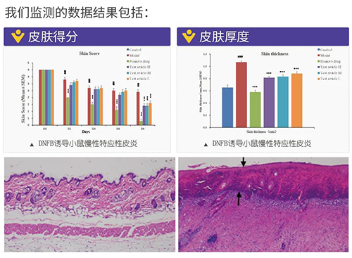 人生就是博官方网站建设的特应性皮炎及湿疹模子监测数据效果