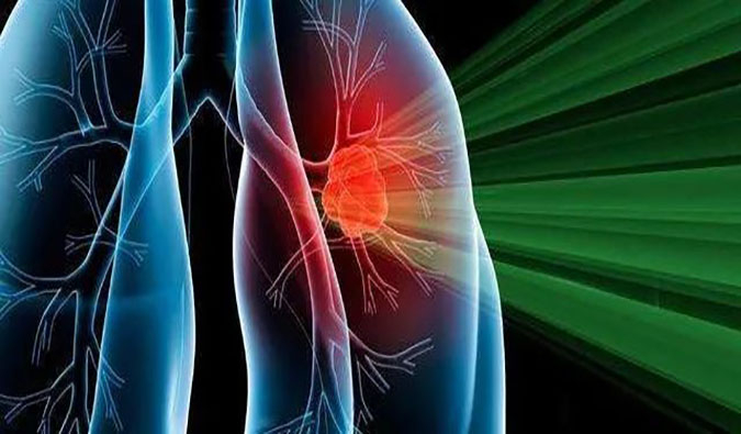 盛世泰科1类立异药物CGT-9475实现中美双报双批 | 人生就是博官方网站一站式临床宿世物医药研发服务平台助力