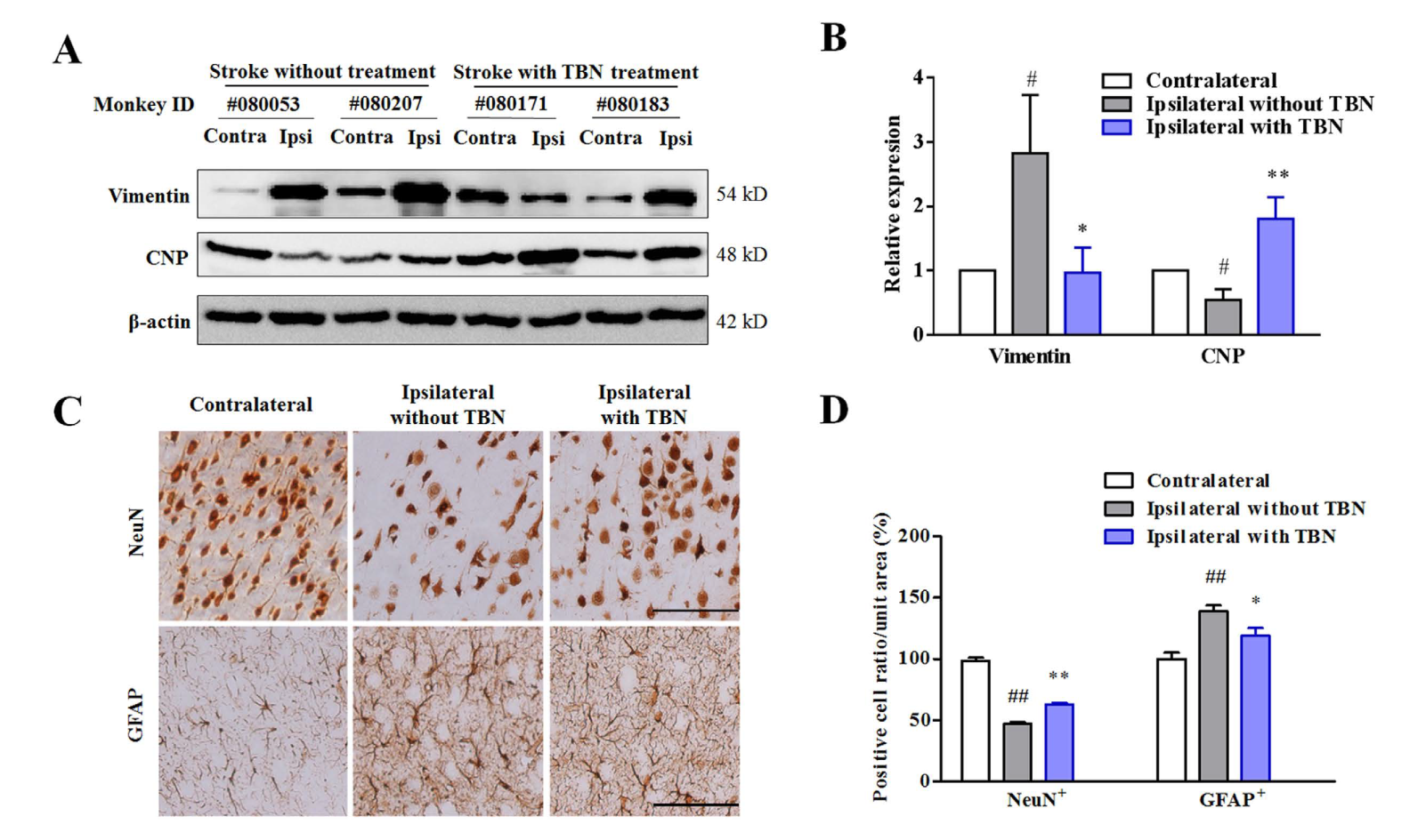 TBN是一种治疗缺血性卒中的新型临床候选药物，，本研究中TBN通过人生就是博官方网站合成